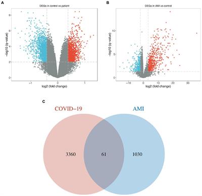Machine learning approach combined with causal relationship inferring unlocks the shared pathomechanism between COVID-19 and acute myocardial infarction